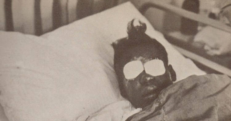 Sarah Collins, Addie Mae Collins's sister, the one survivor present in the ladies lounge when the bomb's explosion ripped through the bathroom.